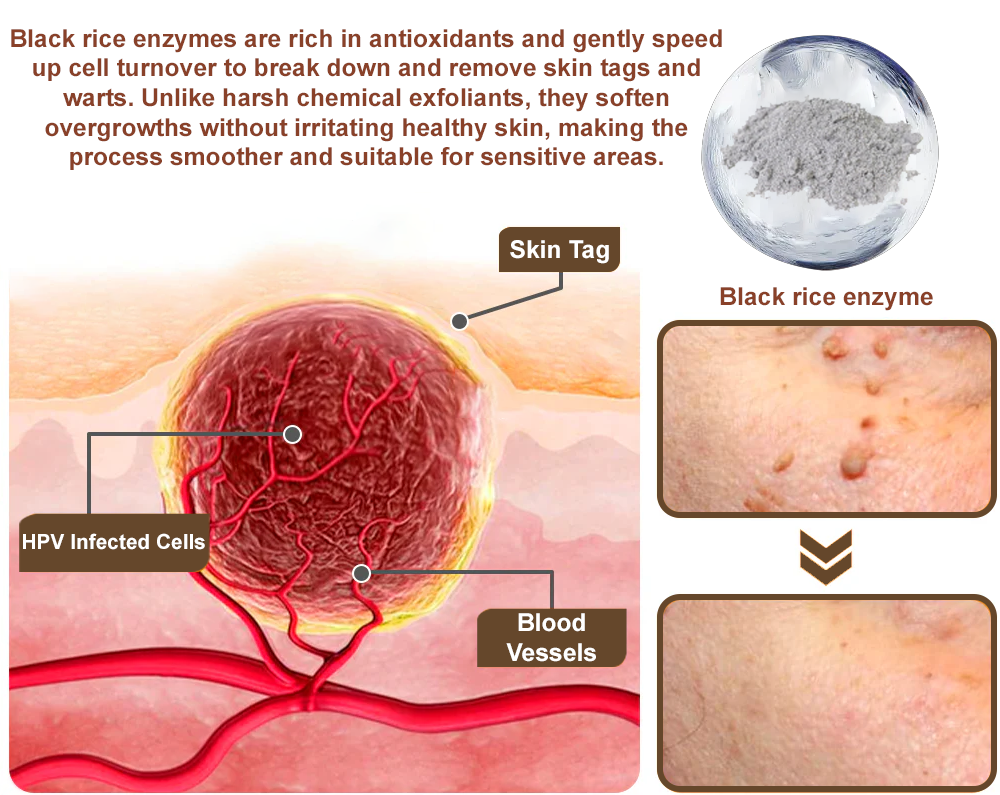 Still letting these skin issues mess with you on repeat? đ đ¨ââď¸ TGA-Certified LOVILDSÂŽ Black Rice Skin Repair Essence Cream: One cream, multiple benefitsârescue your troubled skin!
