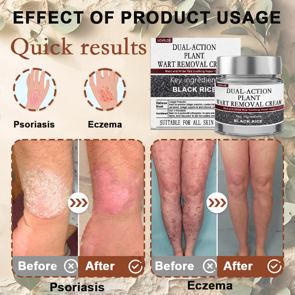 Still letting these skin issues mess with you on repeat? đ đ¨ââď¸ TGA-Certified LOVILDSÂŽ Black Rice Skin Repair Essence Cream: One cream, multiple benefitsârescue your troubled skin!