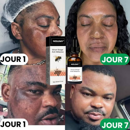 ✨Sérum Correcteur des Taches Brunes